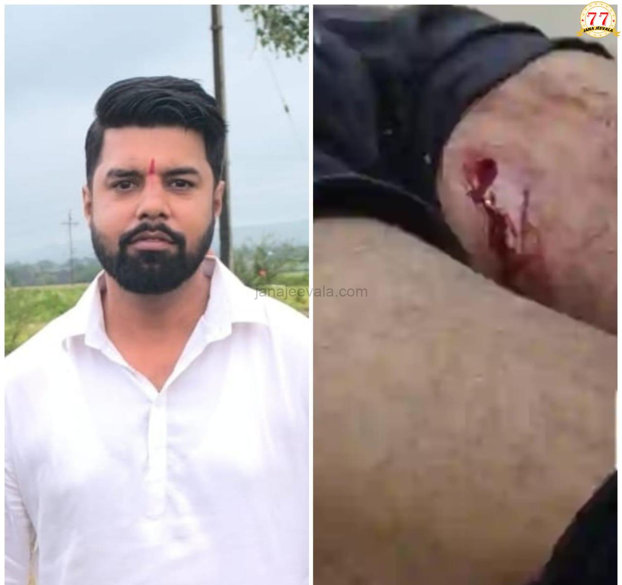 ದೇಹಕ್ಕೆ ತಾಗಿ ಗುಂಡುಗಳನ್ನ ಜೇಬಿನಲ್ಲಿ ಇಟ್ಟುಕೊಂಡು ಬಂದ ಗಾಯಾಳು