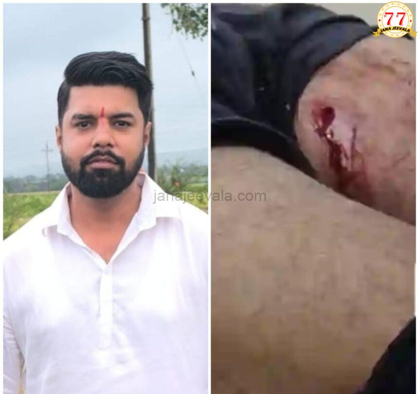 ದೇಹಕ್ಕೆ ತಾಗಿ ಗುಂಡುಗಳನ್ನ ಜೇಬಿನಲ್ಲಿ ಇಟ್ಟುಕೊಂಡು ಬಂದ ಗಾಯಾಳು ದೇಹಕ್ಕೆ ತಾಗಿ ಗುಂಡುಗಳನ್ನ ಜೇಬಿನಲ್ಲಿ ಇಟ್ಟುಕೊಂಡು ಬಂದ ಗಾಯಾಳು